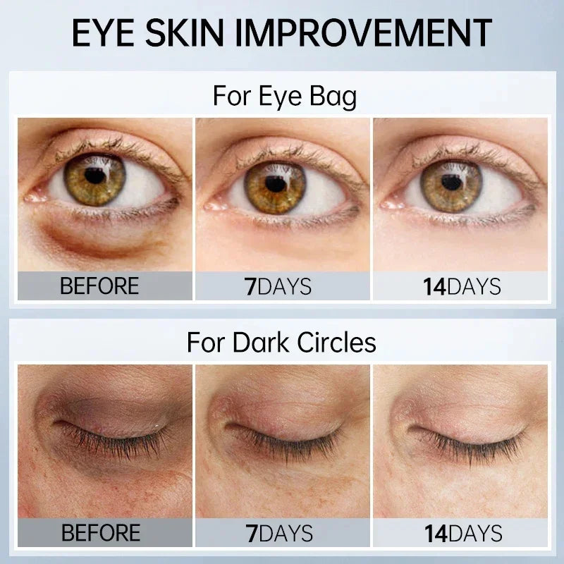 Retinol Eye Cream for Dark Circles, Puffiness, and Fine Lines - Anti-Aging Serum for Firm and Lifted Eye Care