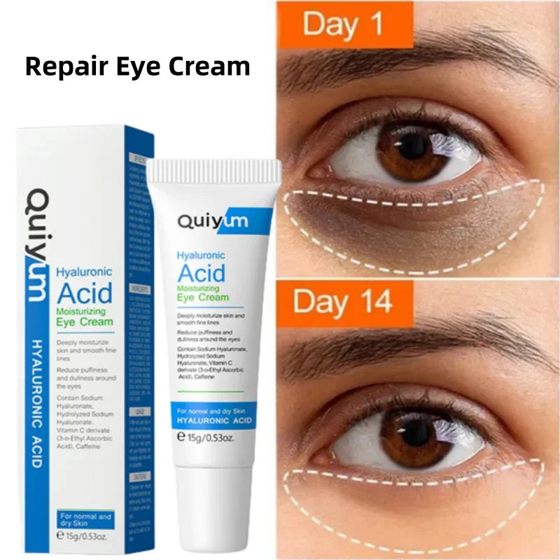 Retinol Eye Cream for Dark Circles, Puffiness, and Fine Lines - Anti-Aging Serum for Firm and Lifted Eye Care