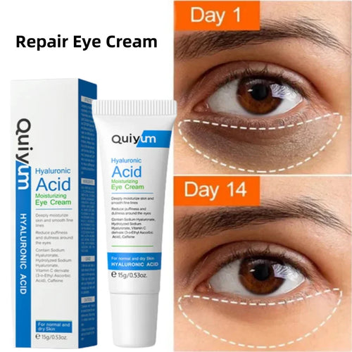 Retinol Eye Cream for Dark Circles, Puffiness, and Fine Lines - Anti-Aging Serum for Firm and Lifted Eye Care