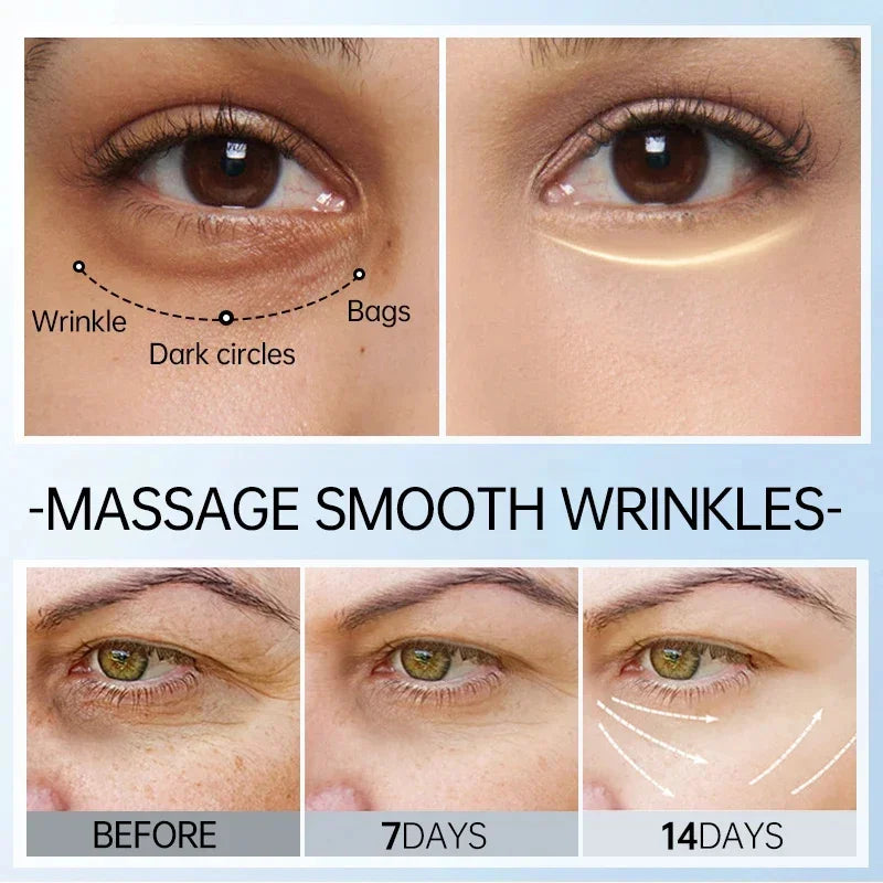 Retinol Eye Cream for Dark Circles, Puffiness, and Fine Lines - Anti-Aging Serum for Firm and Lifted Eye Care